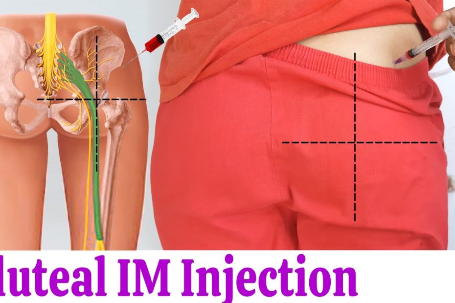 How To Give An Im Intramuscular Injection In Buttock Or Hip Easily At Home  - Youtube